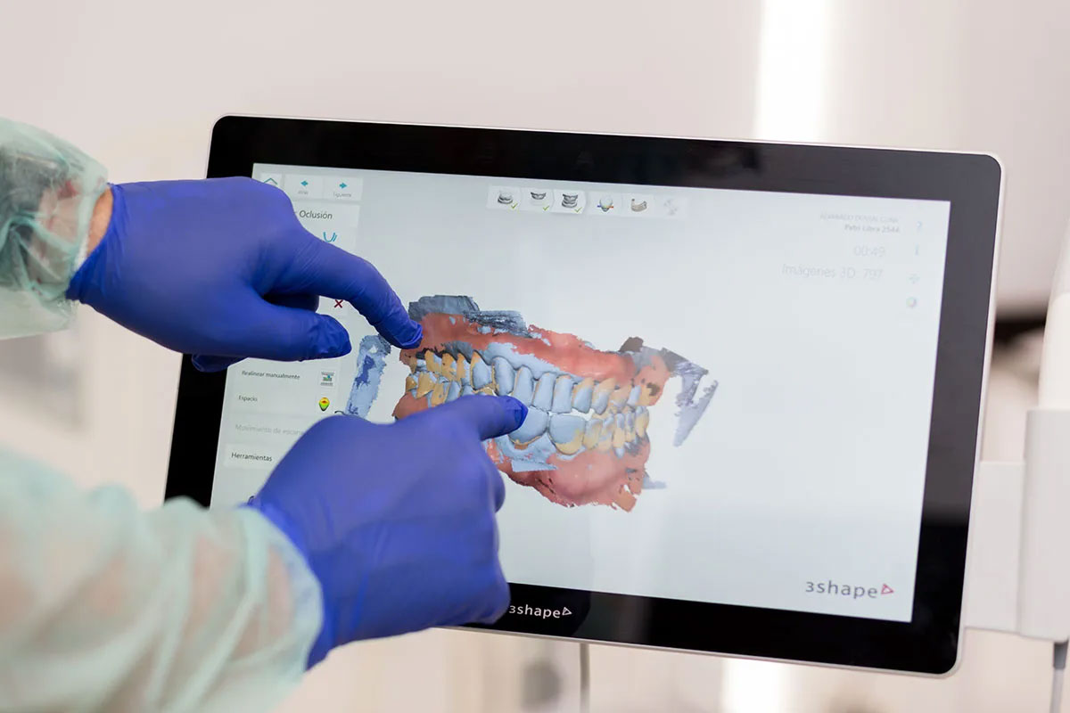 No_conviene_esperar_2