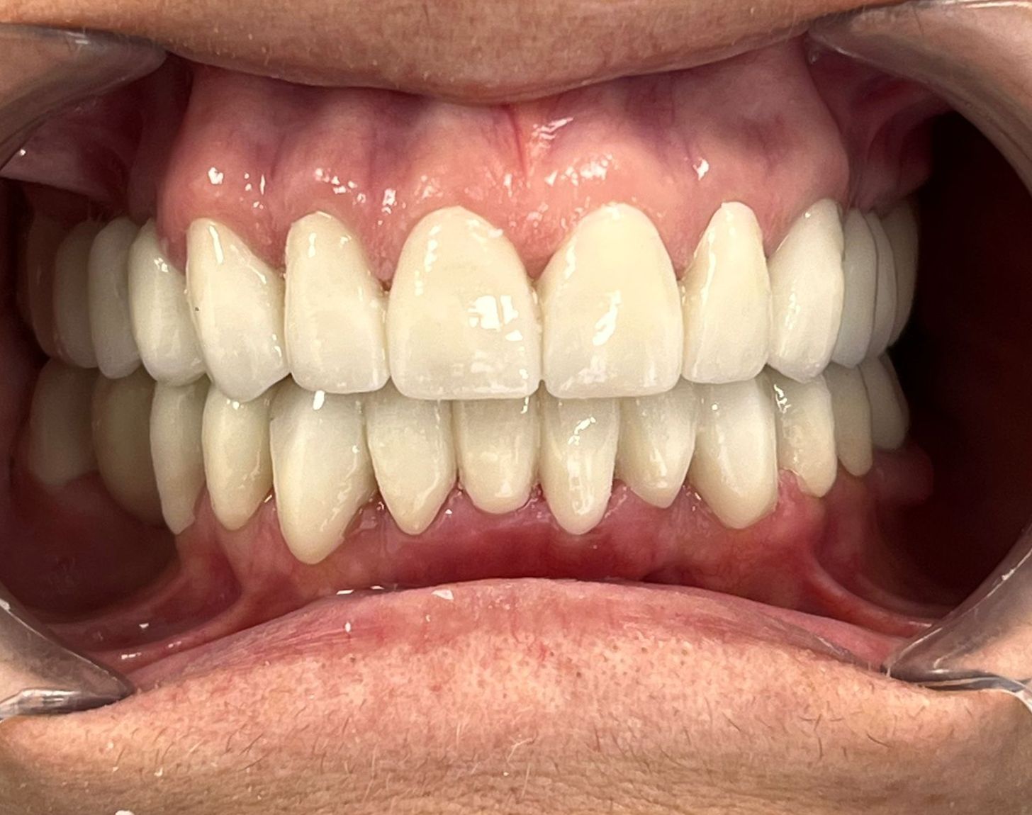 PHOTO-2026-01-29-13-40-21_chico